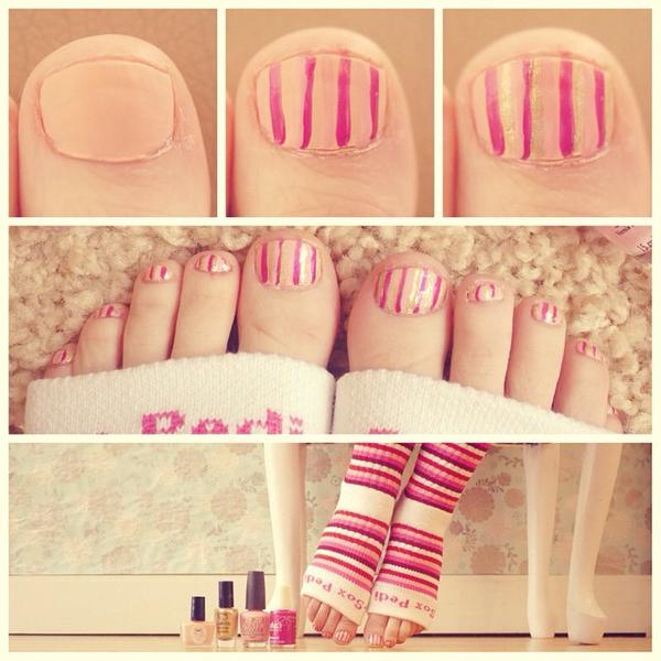 Original Pedi-Sox® - Professional - Multi-Pink Stripes